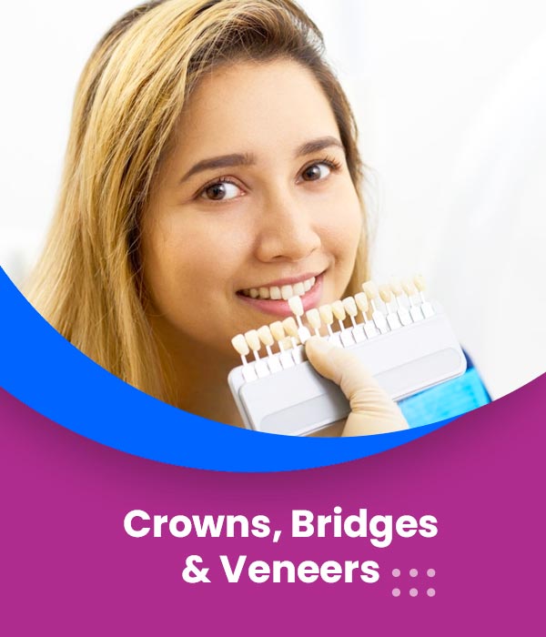crowns-bridges-veneers