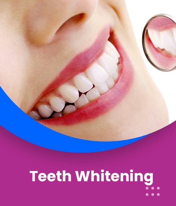 teeth-whitening